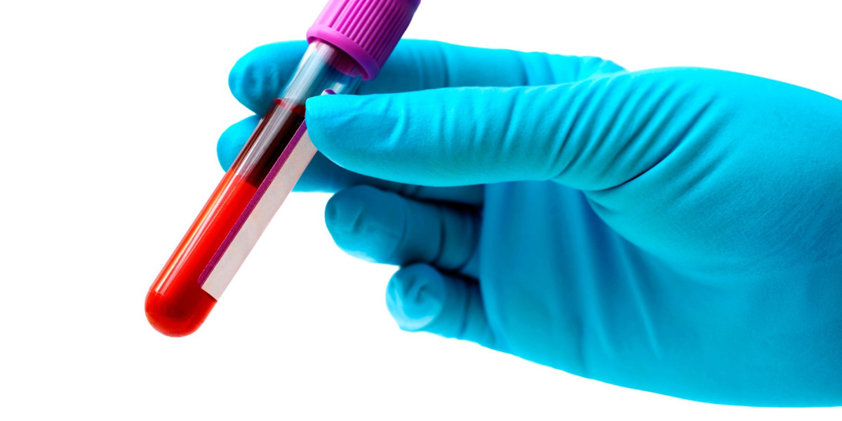 Is there a blood test for cancer? Testing, diagnosis, and results