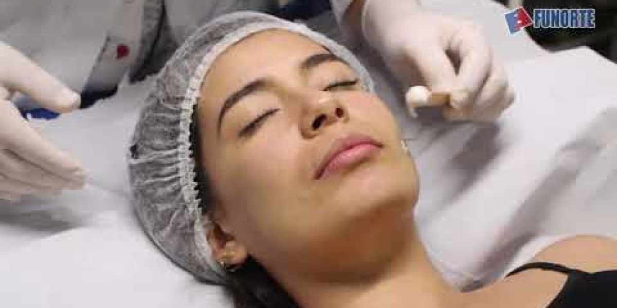 Thread Lift Face Lifts: Benefits, Cost, Results, and More