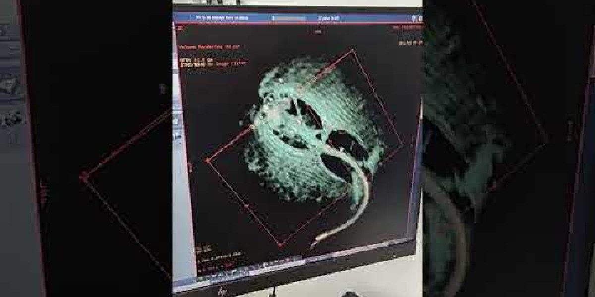 Radiographic evaluation of pulmonary patterns and disease Proceedings